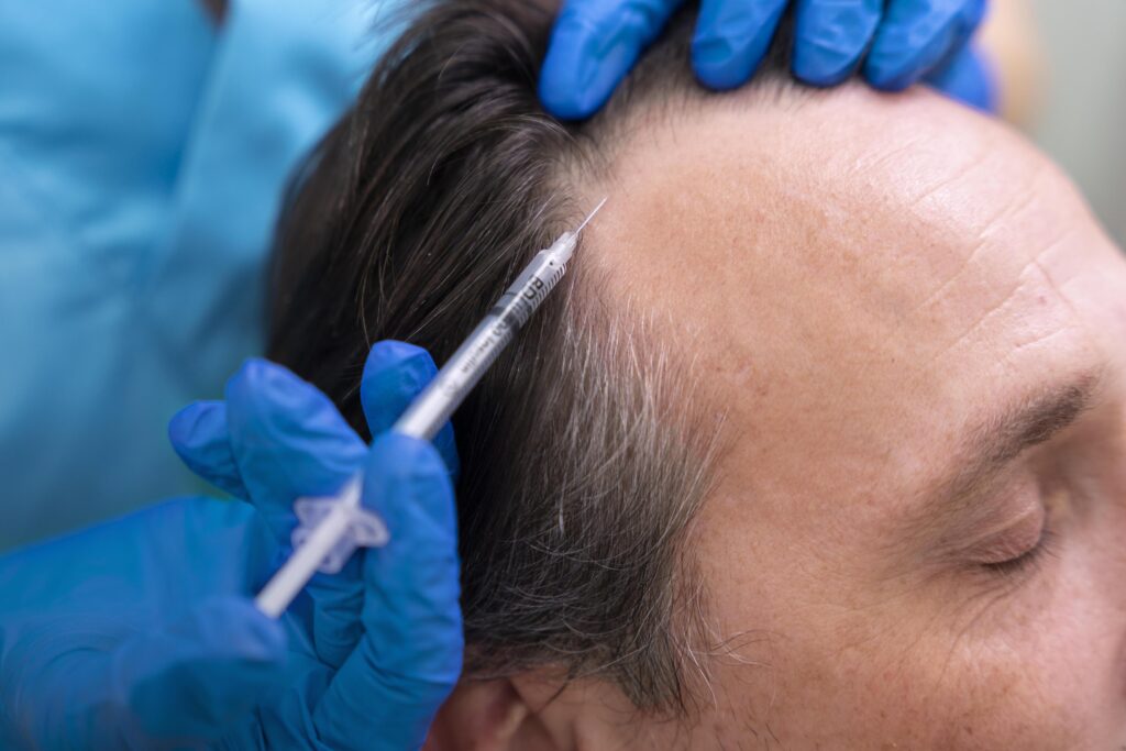 Adult male getting hair loss treatment