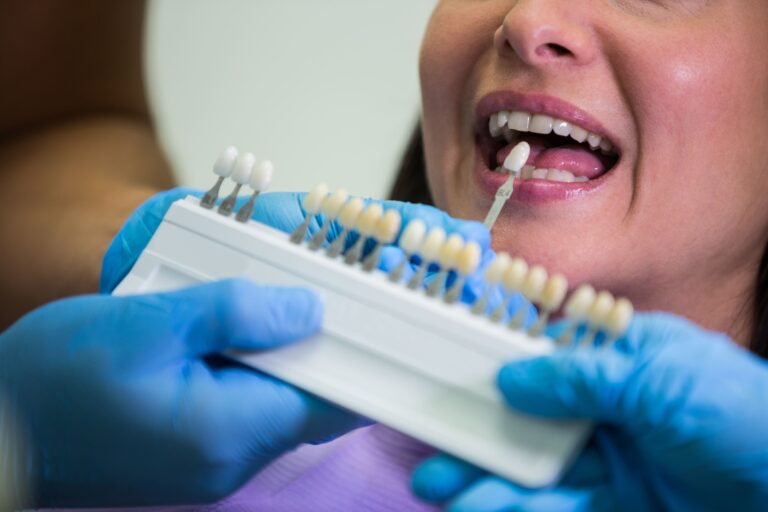 Dentis examining female patient with teeth shades