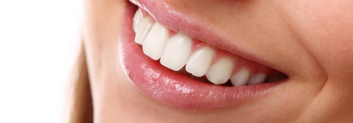 Turkey Teeth: The Rising Trend and What You Need to Know